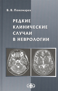 Редкие клинические случаи в неврологии Редкие клинические случаи в неврологии