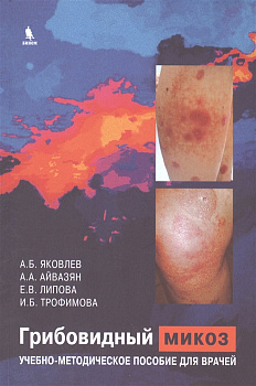 Грибовидный микоз