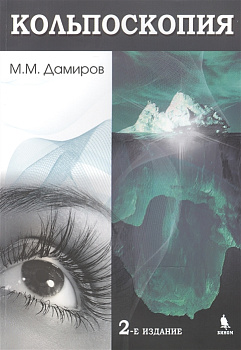 Кольпоскопия