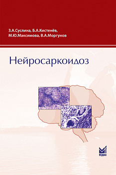 Нейросаркоидоз