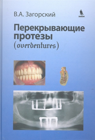 7382