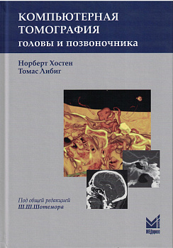 Компьютерная томография головы и позвоночника