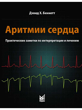Аритмии сердца. Практические заметки по интерпретации и лечению. 