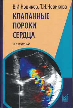 Клапанные пороки сердца