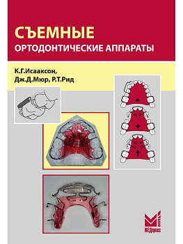 Съемные ортодонтические аппараты