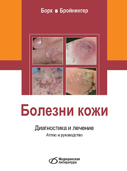 Болезни кожи. Диагностика и лечение. Атлас и руководство