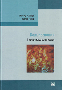 Кольпоскопия.