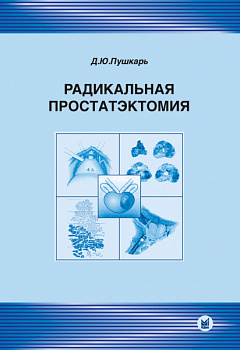 Радикальная простатэктомия