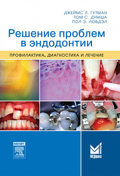Решение проблем в эндодонтии.