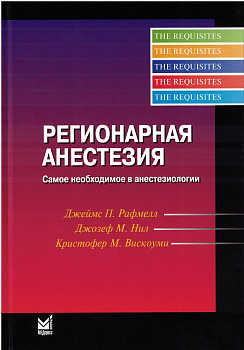 Регионарная анестезия