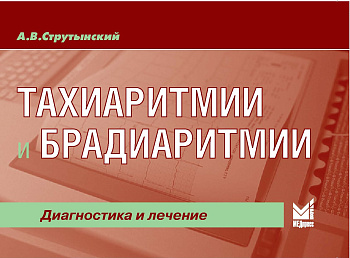 Тахиаритмии и брадиаритмии. Диагностика и лечение