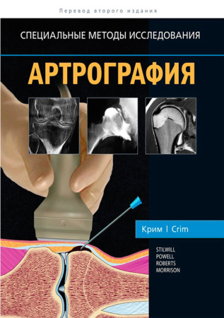 NF0017437.files_