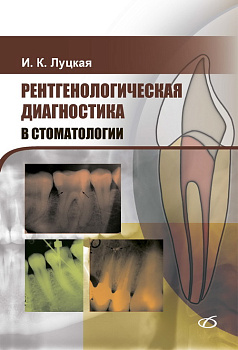 Рентгенологическая диагностика в стоматологии