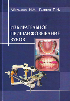Избирательное пришлифовывание зубов