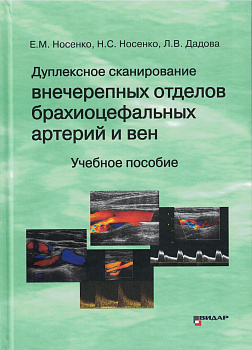 Дуплексное сканирование внечерепных отделов брахиоцефальных артерий и вен