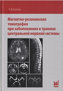 Магнитно-резонансная томография при заболеваниях и травмах центральной нервной системы