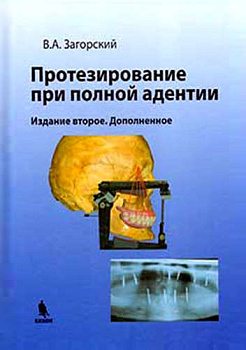 Протезирование при полной адентии