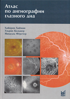 Атлас по ангиографии глазного дна