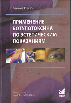 Применение ботулотоксина по эстетическим показаниям
