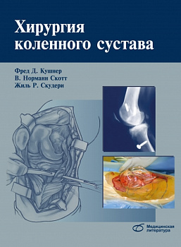 Хирургия коленного сустава