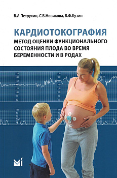Кардиотокография - метод оценки функционального состояния плода во время беременности