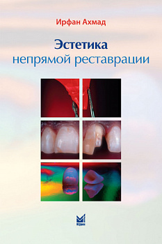 Эстетика непрямой реставрации