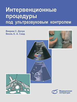 Интервенционные процедуры под ультразвуковым контролем