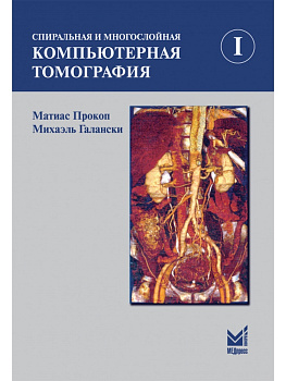 Спиральная и многослойная компьютерная томография. 1 том