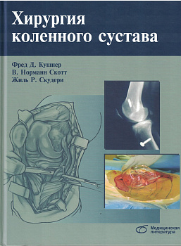 Хирургия коленного сустава