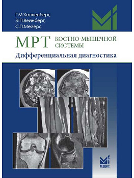 МРТ костно-мышечной системы. Дифференциальная диагностика