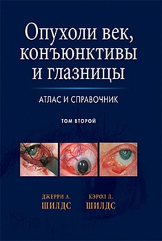 Опухоли век, конъюнктивы и глазницы, т.2