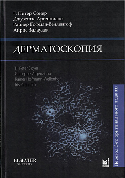Дерматоскопия