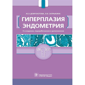 Гиперплазия эндометрия