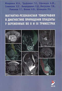 Магнитно-резонансная томография в диагностике приращения плаценты у беременных во II и III триместра