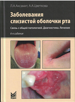 Заболевания слизистой оболочки рта