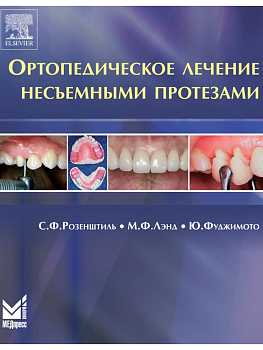 Ортопедическое лечение несъемными протезами