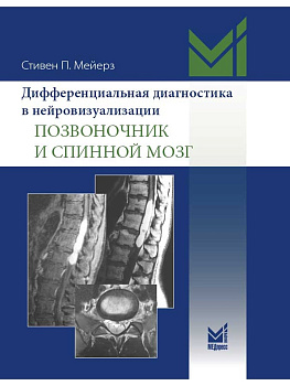 Дифференциальная диагностика в нейровизуализации. Позвоночник и спинной мозг