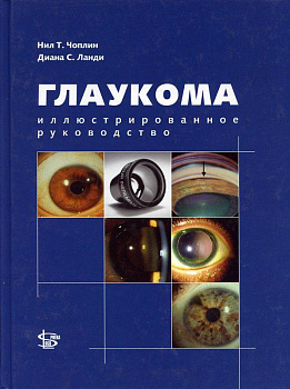 Глаукома: иллюстрированное руководство