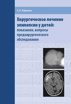 Хирургическое лечение эпилепсии у детей: показания, вопросы предхирургического обследования.