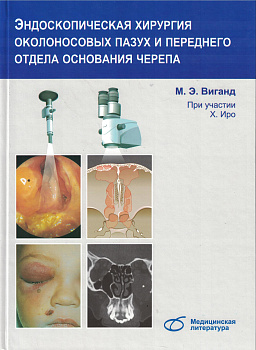 Эндоскопическая хирургия околоносовых пазух и переднего отдела основания черепа