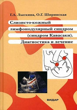 Слизисто-кожный лимфонодулярный синдром (синдром Кавасаки). Диагностика и лечение Слизисто-кожный лимфонодулярный синдром (синдром Кавасаки). Диагностика и лечение