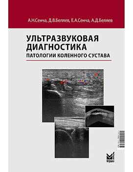 Ультразвуковая диагностика патологии коленного сустава