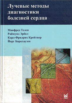 Лучевые методы диагностики болезней сердца