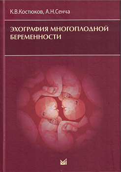 Эхография многоплодной беременности