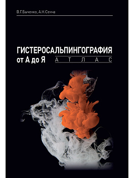 Гистеросальпингография от А до Я: атлас.