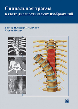 Спинальная травма в свете диагностических изображений Спинальная травма в свете диагностических изображений