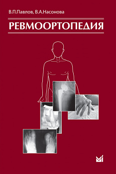 Ревмоортопедия.