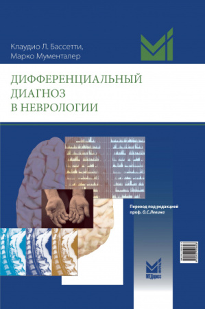 МументалДИФФ