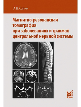 Магнитно-резонансная томография при заболеваниях и травмах центральной нервной системы Магнитно-резонансная томография при заболеваниях и травмах центральной нервной системы