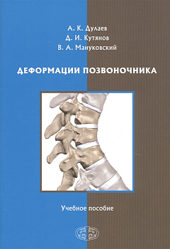 Деформации позвоночника